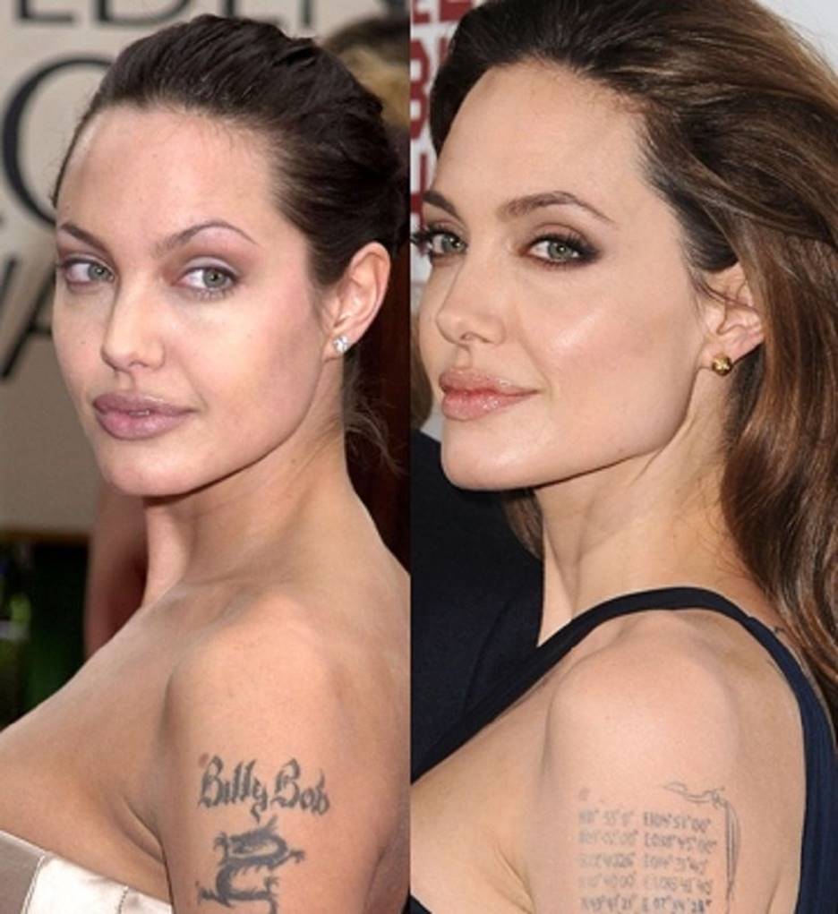 Angelina jolie before and after plastic surgery